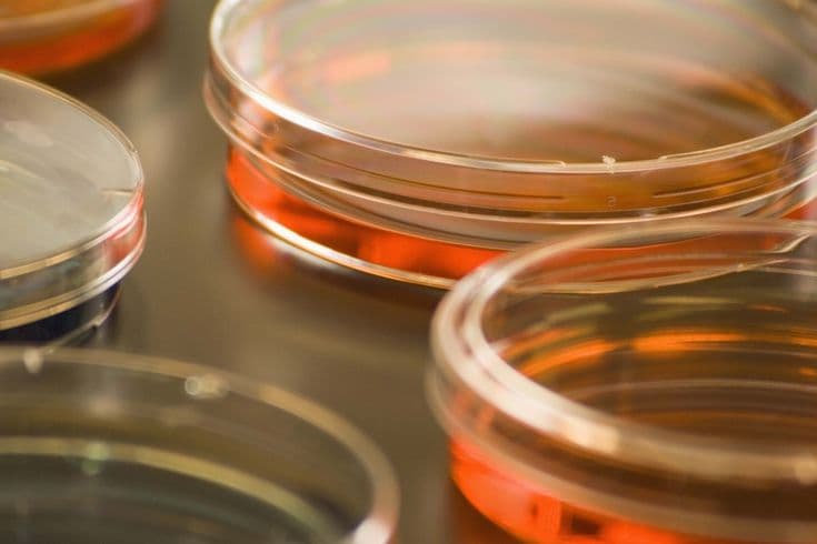 Prepared Culture Media Plates