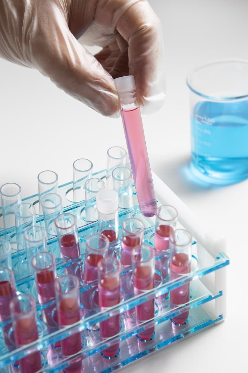 Prepared Culture Media Tubes